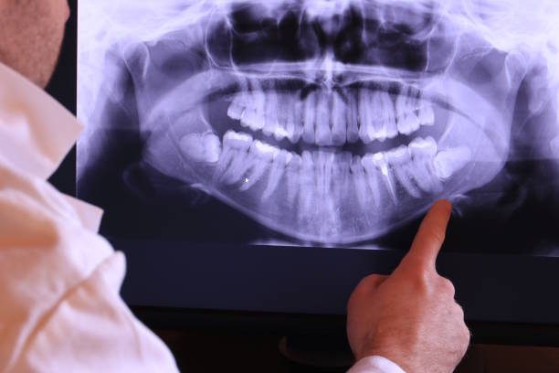 Best Emergency Dentist for Lost Fillings or Crowns in Scissors, TX