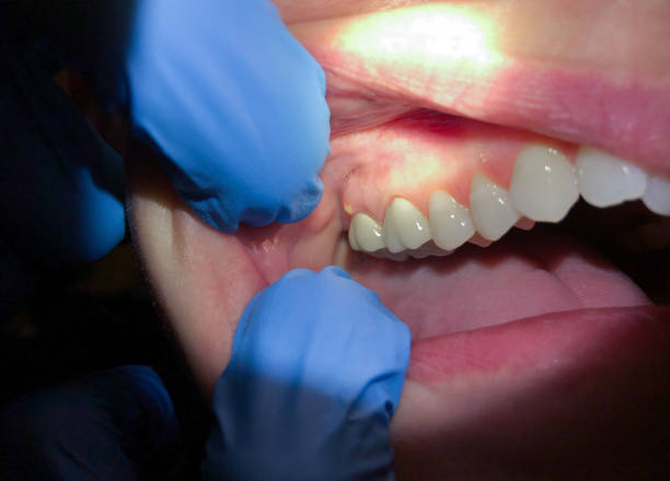 Best Mobile Emergency Dentist in Scissors, TX