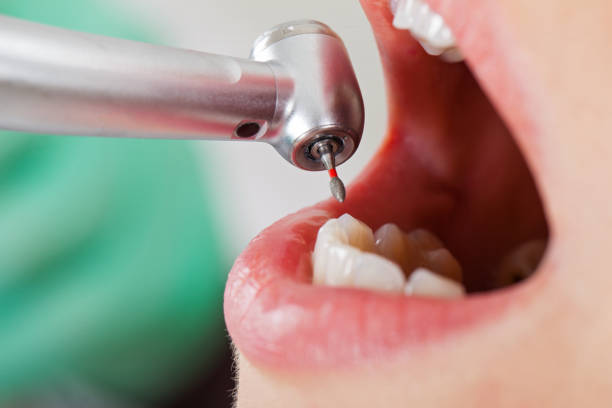 Best Emergency Cosmetic Dentistry in Scissors, TX